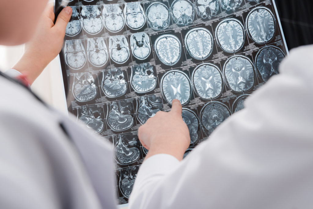 Estudo revela criação de novos neurônios até os 90 anos - Supera - Estimulação Cognitiva