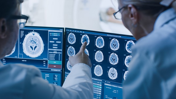 O que é o Acidente Vascular Cerebral; prevenção e cuidados - Supera - Estimulação Cognitiva