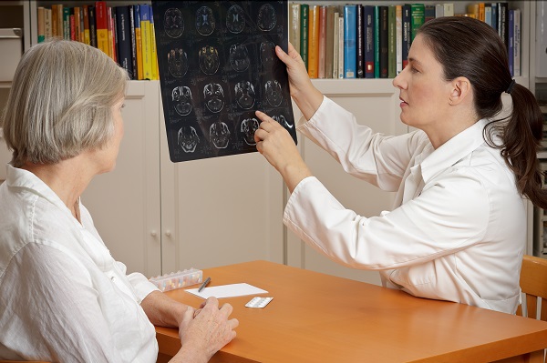 6 dicas importantes para a prevenção de Acidente Vascular Cerebral (AVC) - Supera - Estimulação Cognitiva